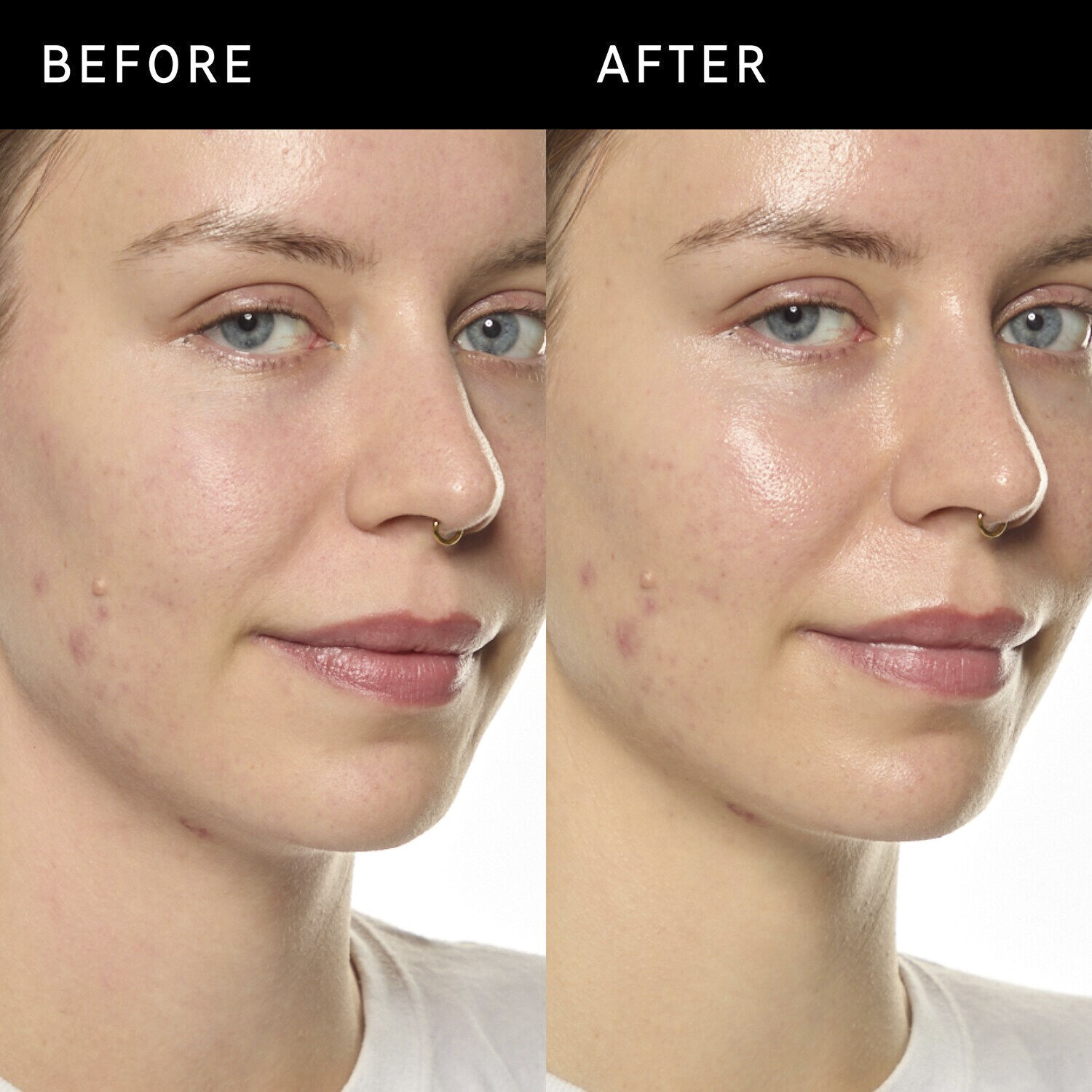 Ectoin Hydro-Barrier Serum - &Aring;terfuktande och skyddande serum