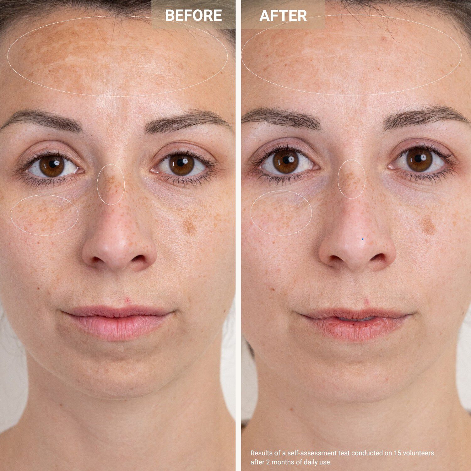 Anti-Redness Clarifying Care - Serum mot rodnad och orenheter