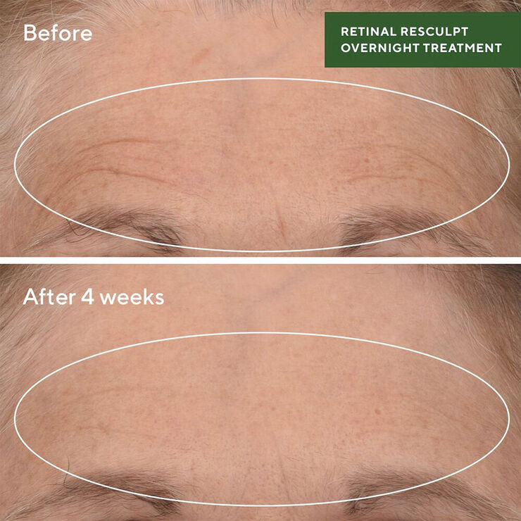 RETINAL RESCULPT OVERNIGHT TREATMEN
