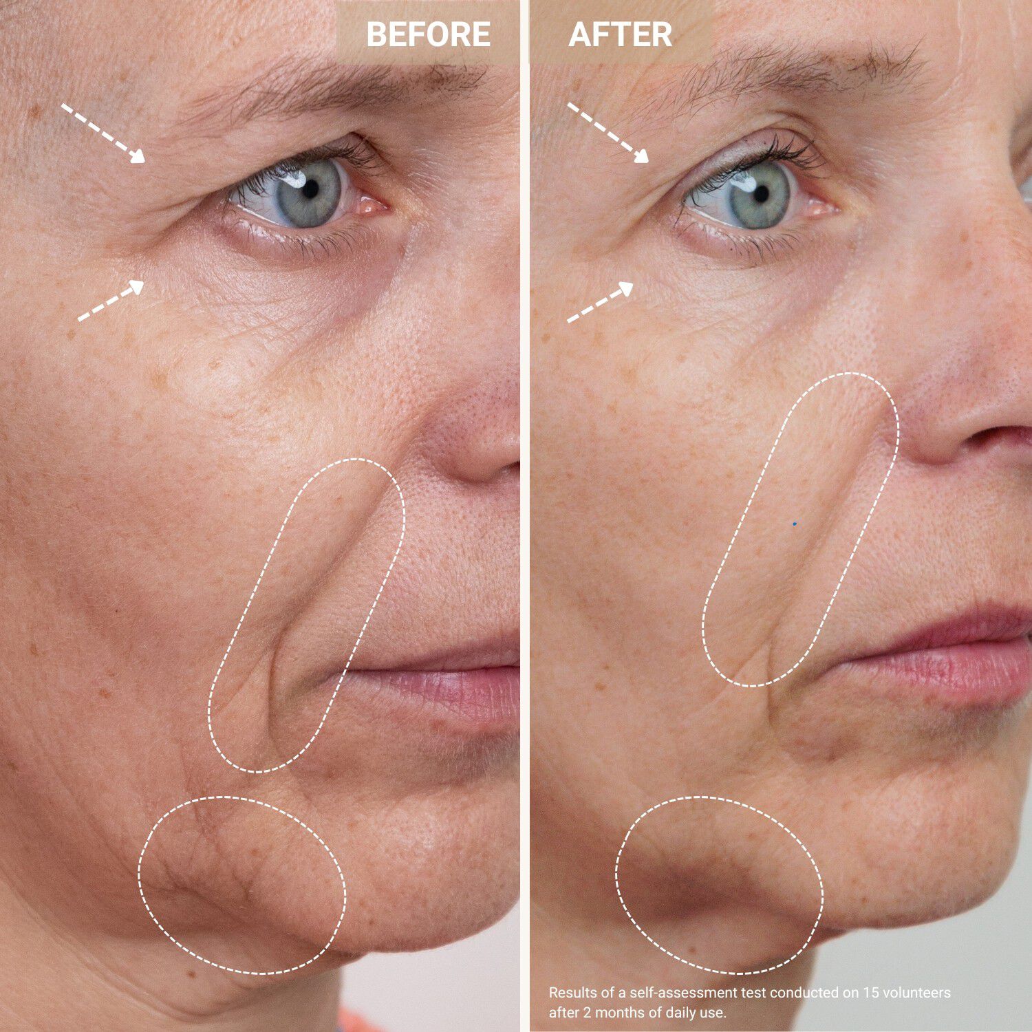 Youth Serum - Anti-aging-serum med kopparpeptider