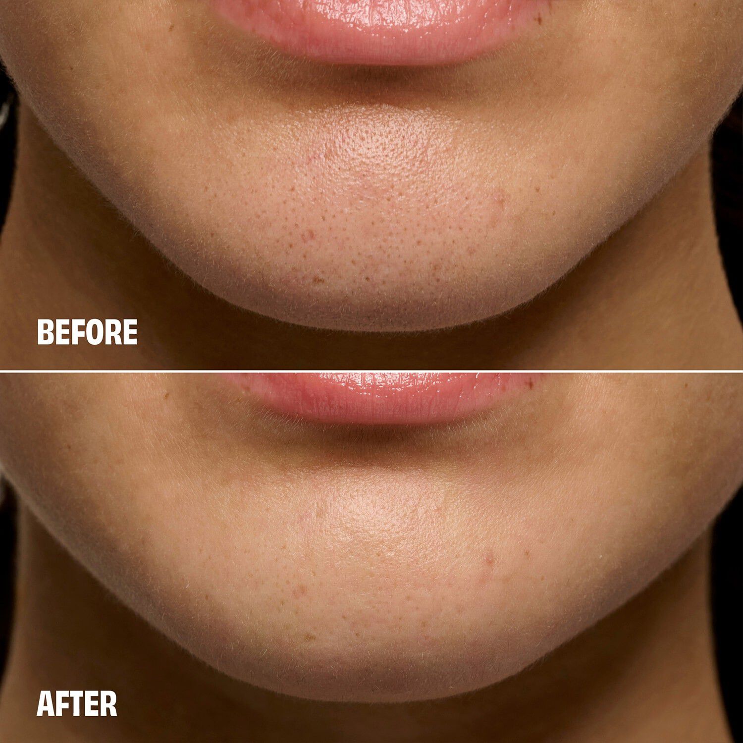 The POREfessional Degunker  F&ouml;r pormaskar & porreng&ouml;ring