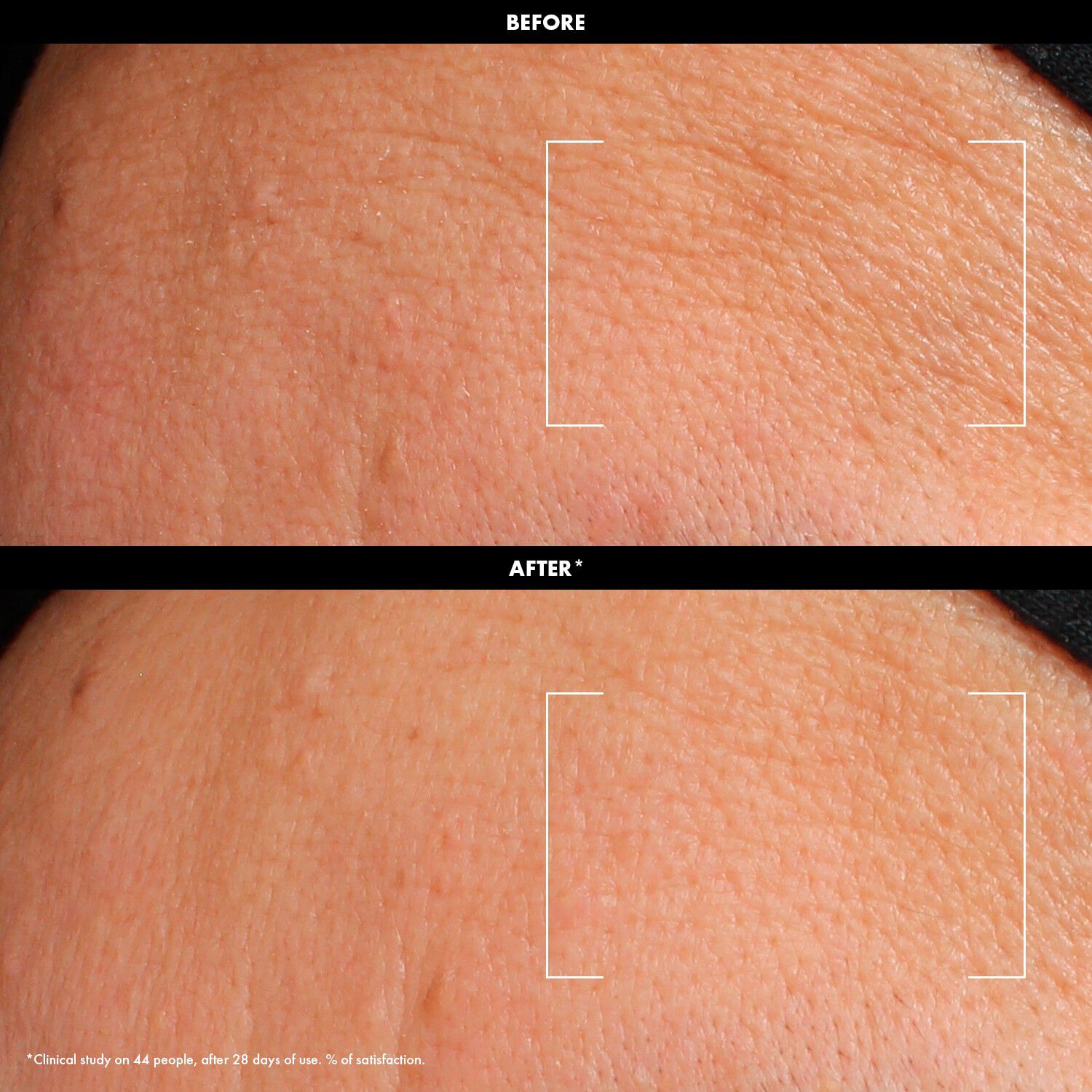 HYDRATE - &Aring;terfuktande mj&ouml;lkig kr&auml;m med hyaluronsyra