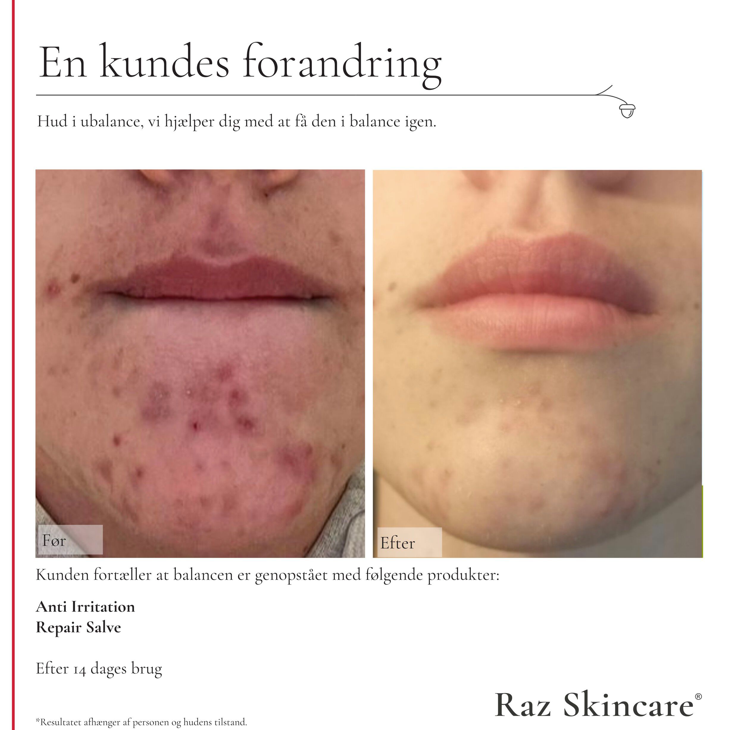 Raz Skincare Repair Salve Perfume Free 100 ml