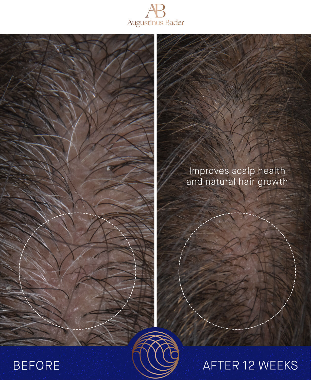 The Leave-In Hair Treatment