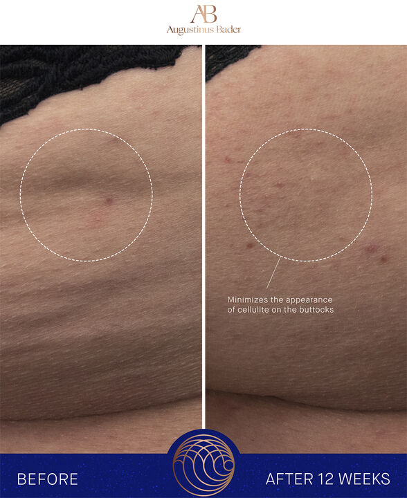 The Body Cream