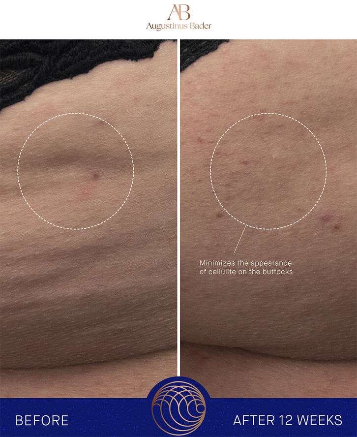 The Body Cream