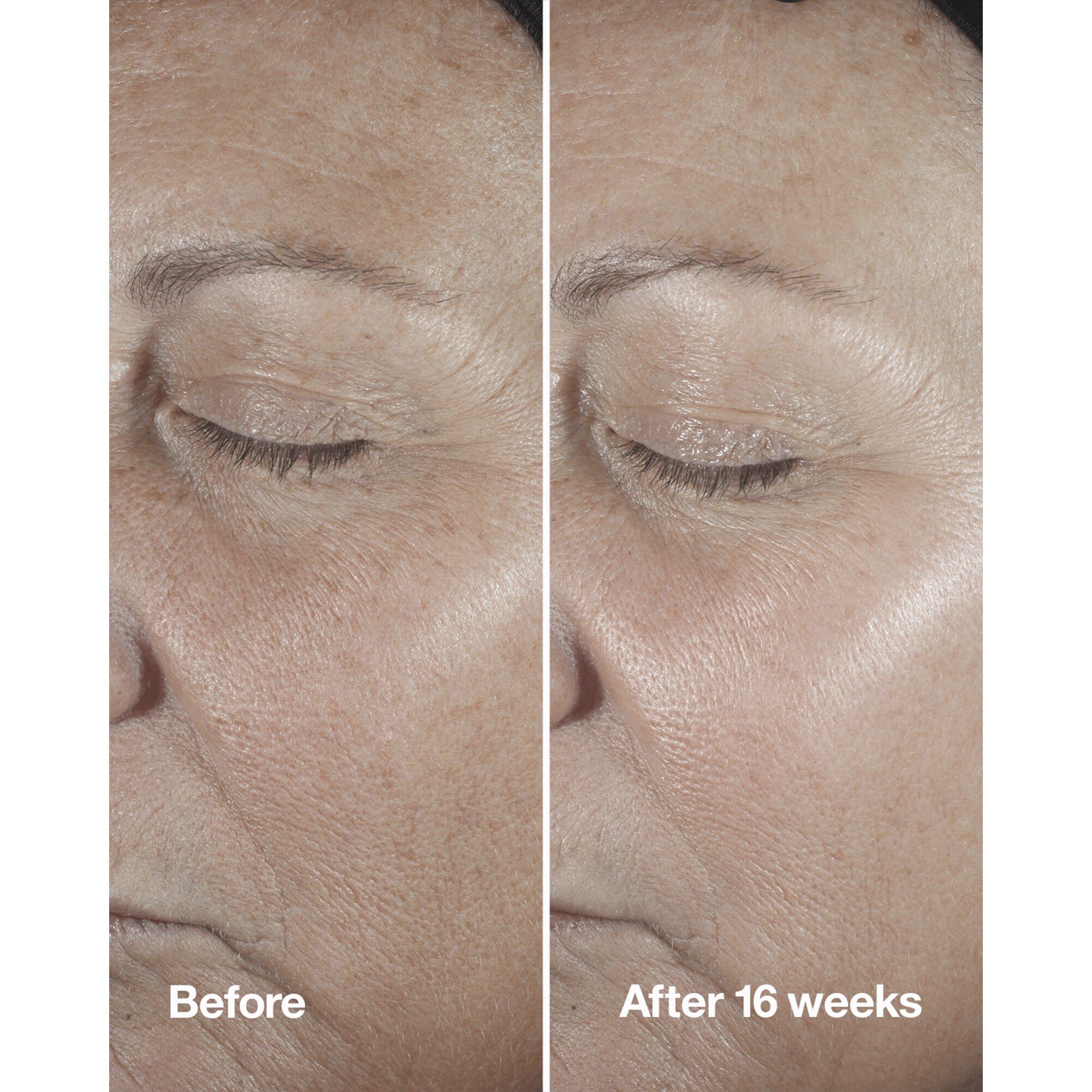 Smart Clinical Repair Wrinkle Correcting Serum