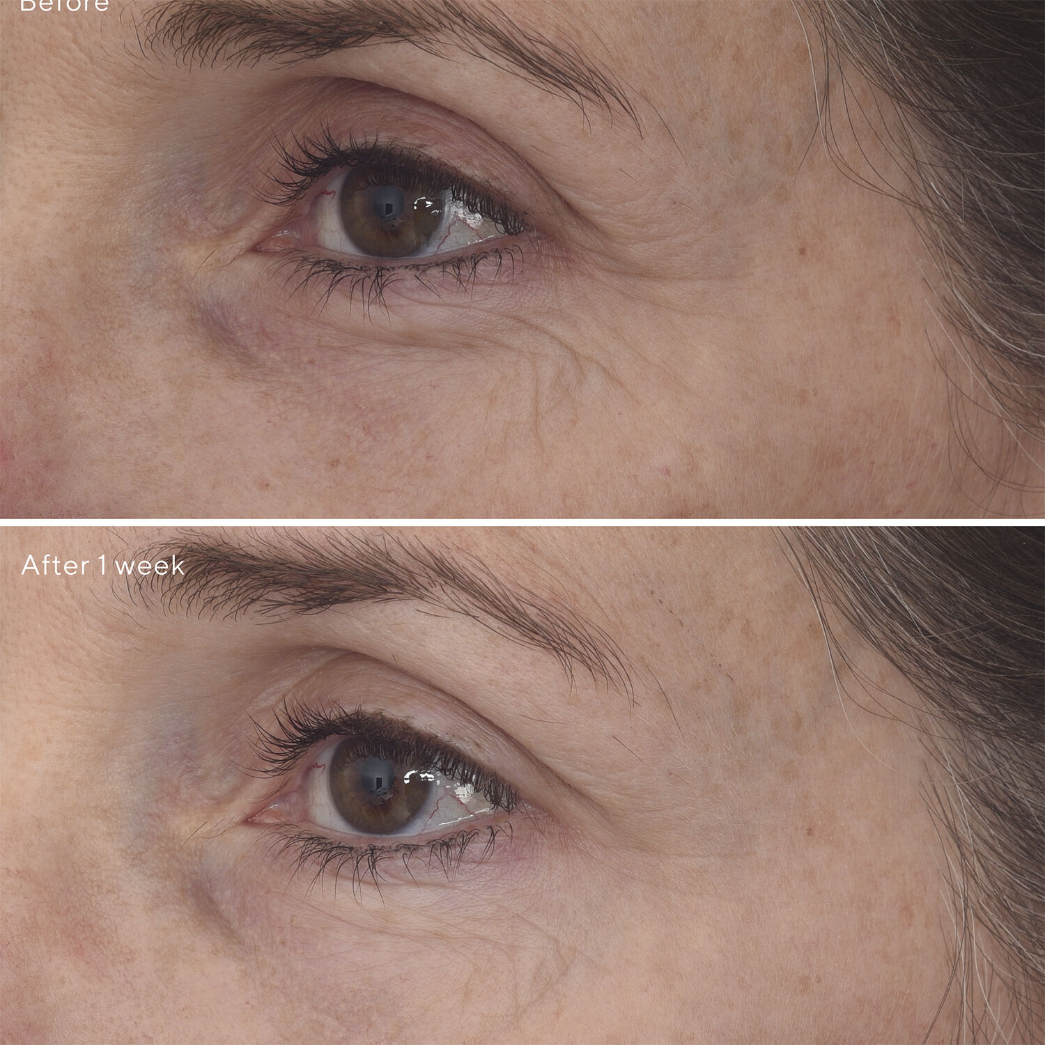 RETINAL RESCUPLT EYE TREATMENT 15 ML