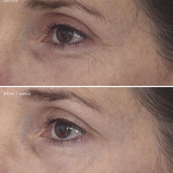 RETINAL RESCUPLT EYE TREATMENT 15 ML