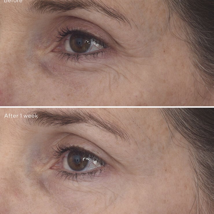 RETINAL RESCUPLT EYE TREATMENT 15 ML