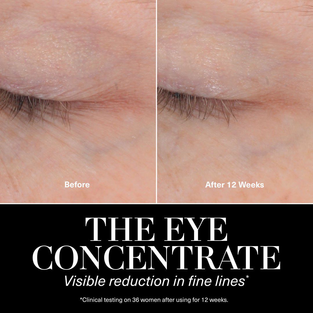 The Eye Concentrate