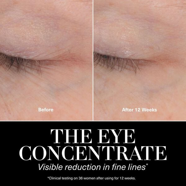The Eye Concentrate