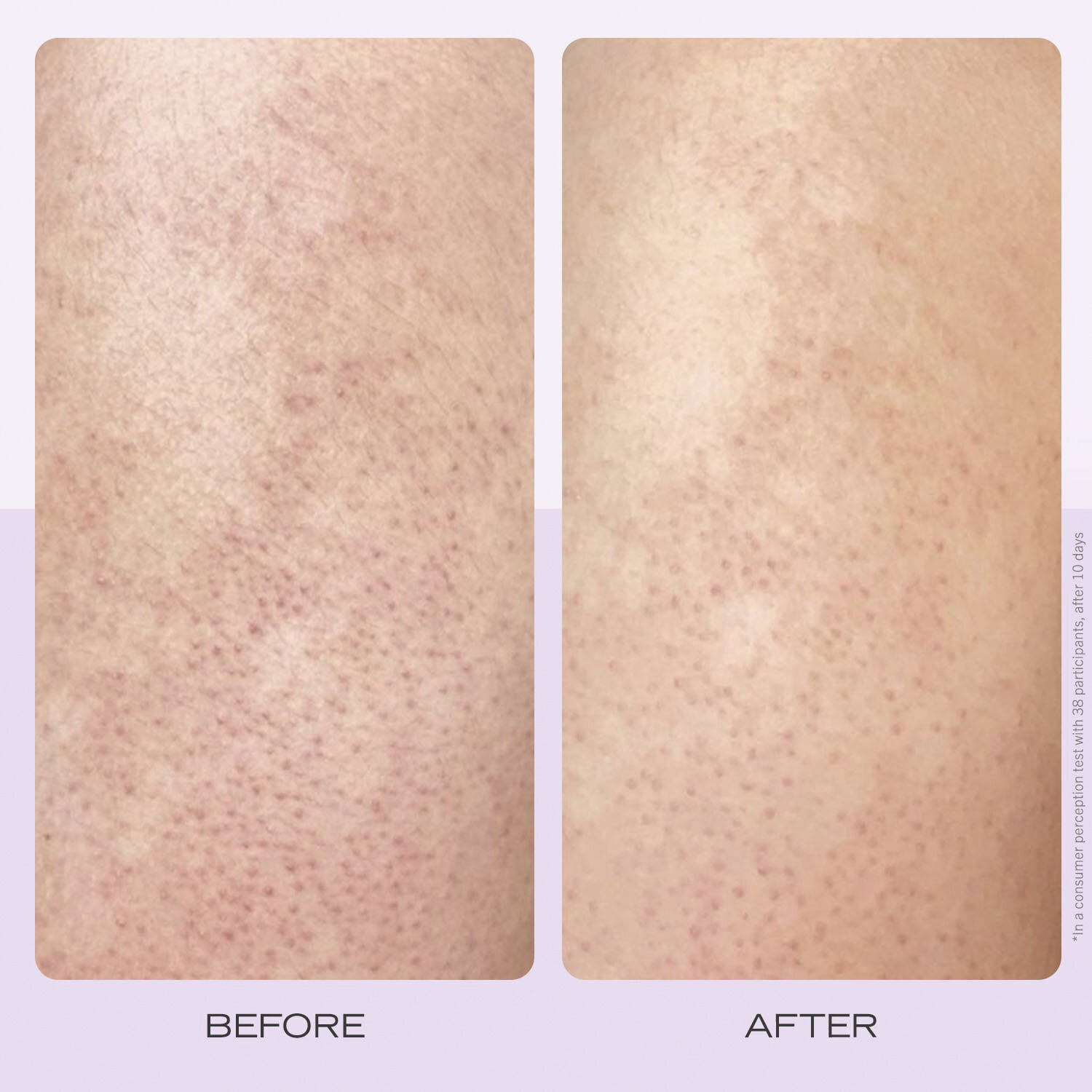 KP Body Scrub Strawberry - Instant Gentle Body Scrub AHA Strawberry