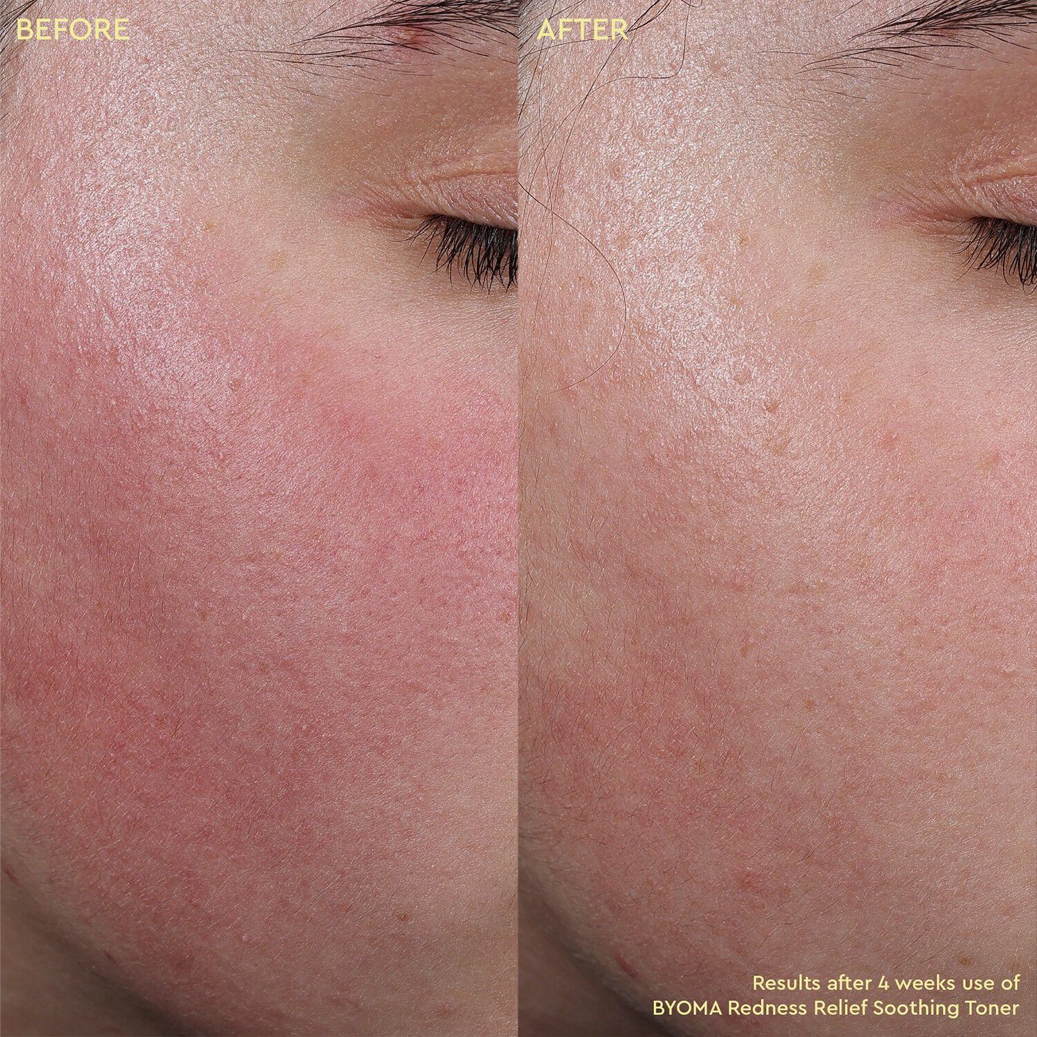 Redness Relief Soothing Toner - Lugnande ansiktsvatten som minskar rod