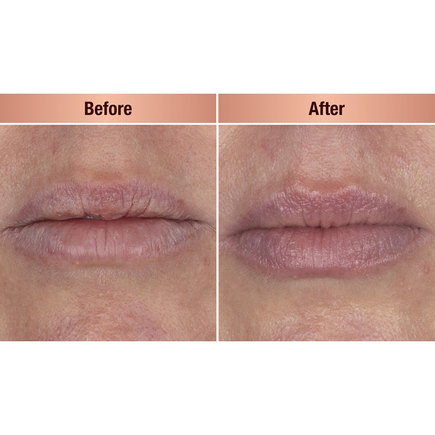 Life Changing Lip Mask nattmask f&ouml;r l&auml;pparna