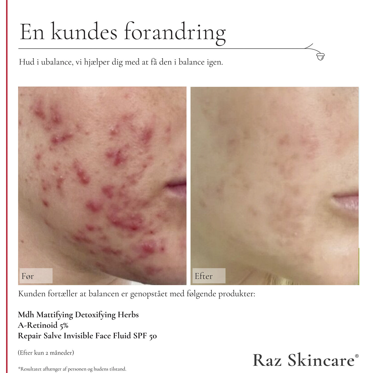 Raz Skincare A-Retinoid 5% 30 ml