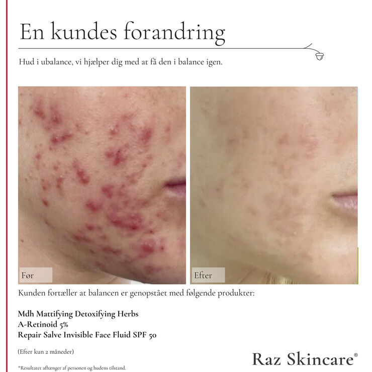 Raz Skincare A-Retinoid 5% 30 ml