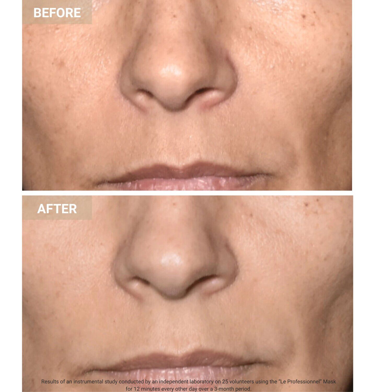 Anti-Aging LED Face Mask The Professional - Anti-aging LED-ansiktsmask