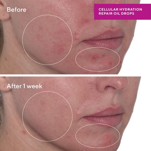 CELLULAR HYDRATION REPAIR OIL DROPS 30 ML