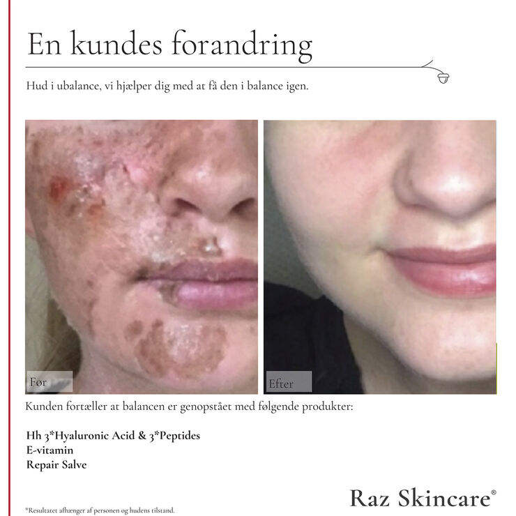 Raz Skincare E-Vitamin 30 ml