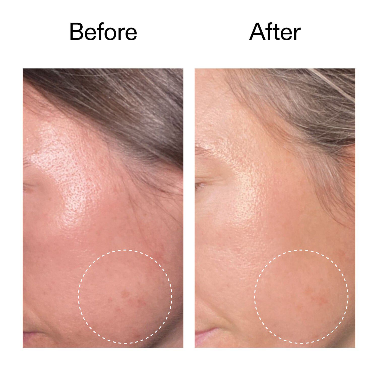 Advanced Retinal Serum - Avancerat retinalserum