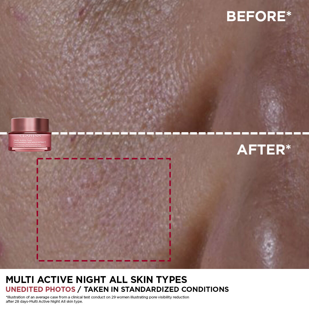 Multi-Active Natcreme Normal/Dry skin