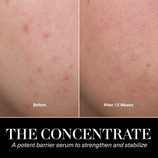 The Concentrate Face Serum