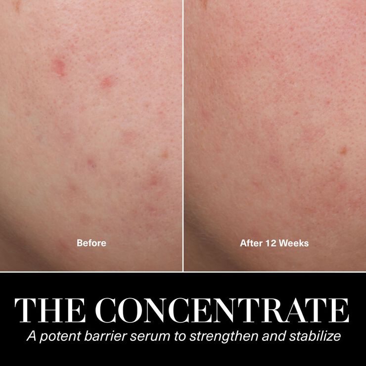 The Concentrate Face Serum