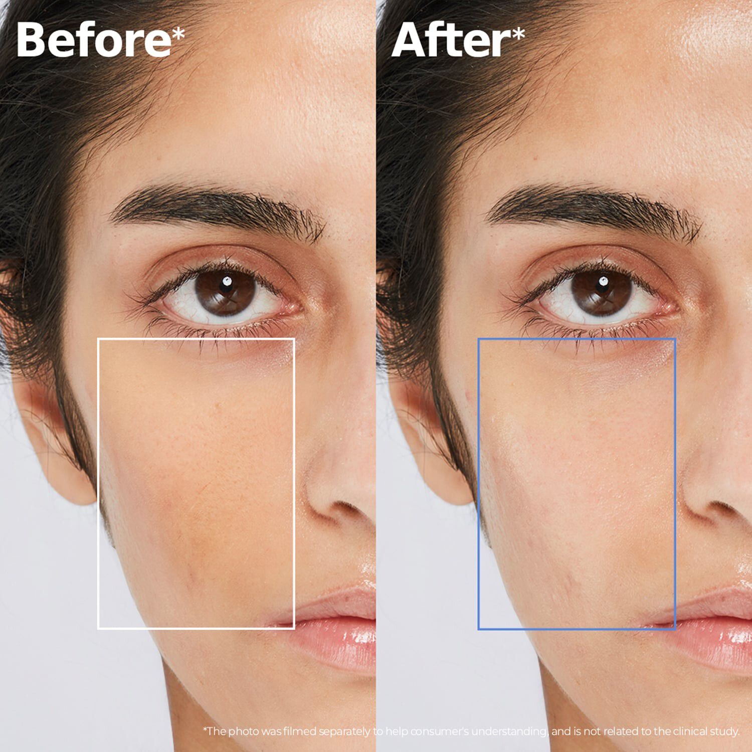 ATOBARRIER365 Hydro-Essence - &Aring;terfuktande essens som v&aring;rdar hudens fu