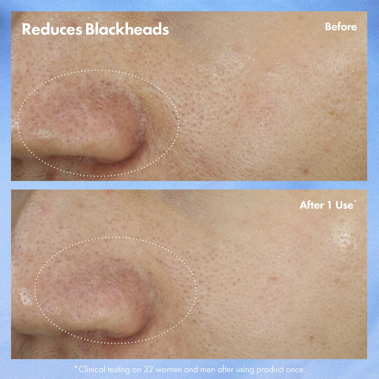 Clear Improvement Blackhead Clearing Mask-To-Scrub