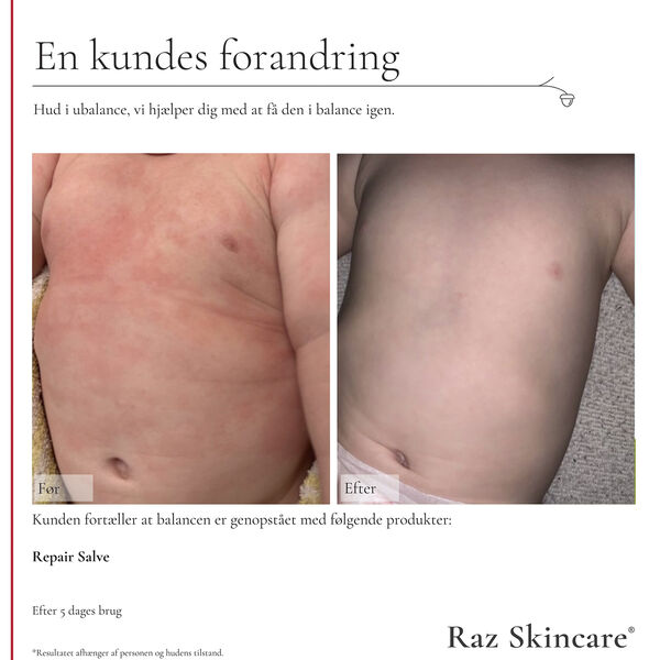 Raz Skincare Repair Salve 100 ml