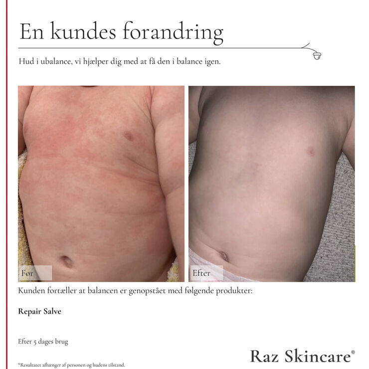 Raz Skincare Repair Salve 100 ml