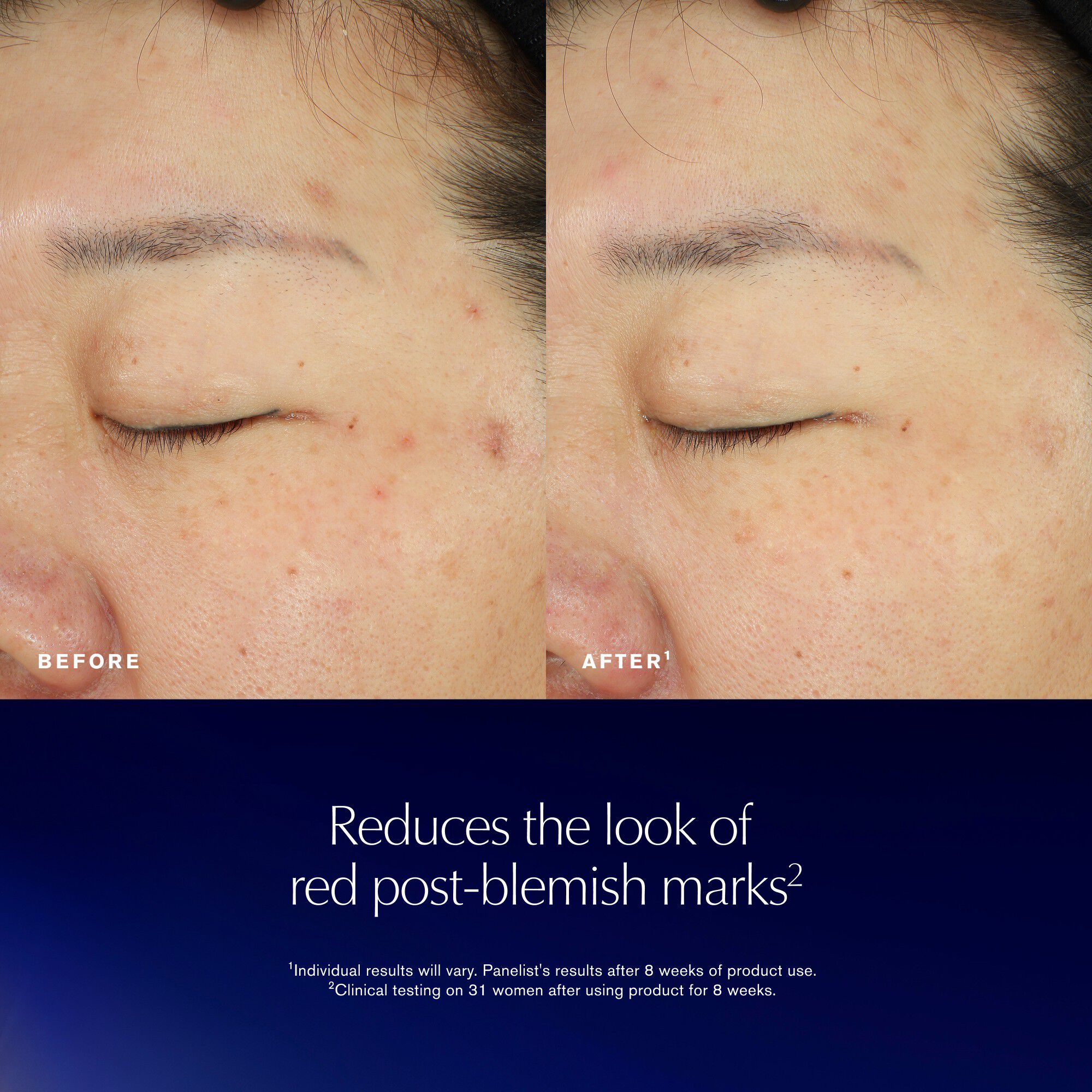 Advanced Night Repair Recovery Treatment Essence