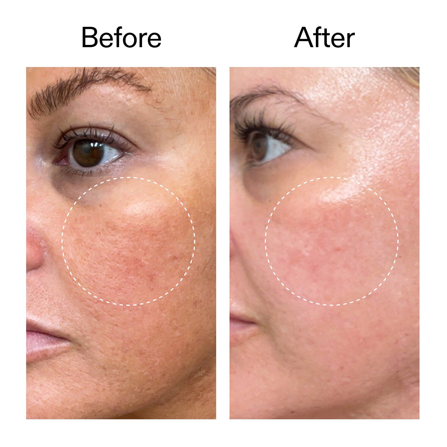 Starter Retinol Serum - Retinolserum f&ouml;r nyb&ouml;rjare