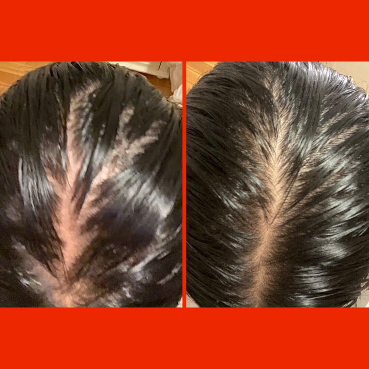 HoliRoots - H&aring;rolja f&ouml;r starkare h&aring;r