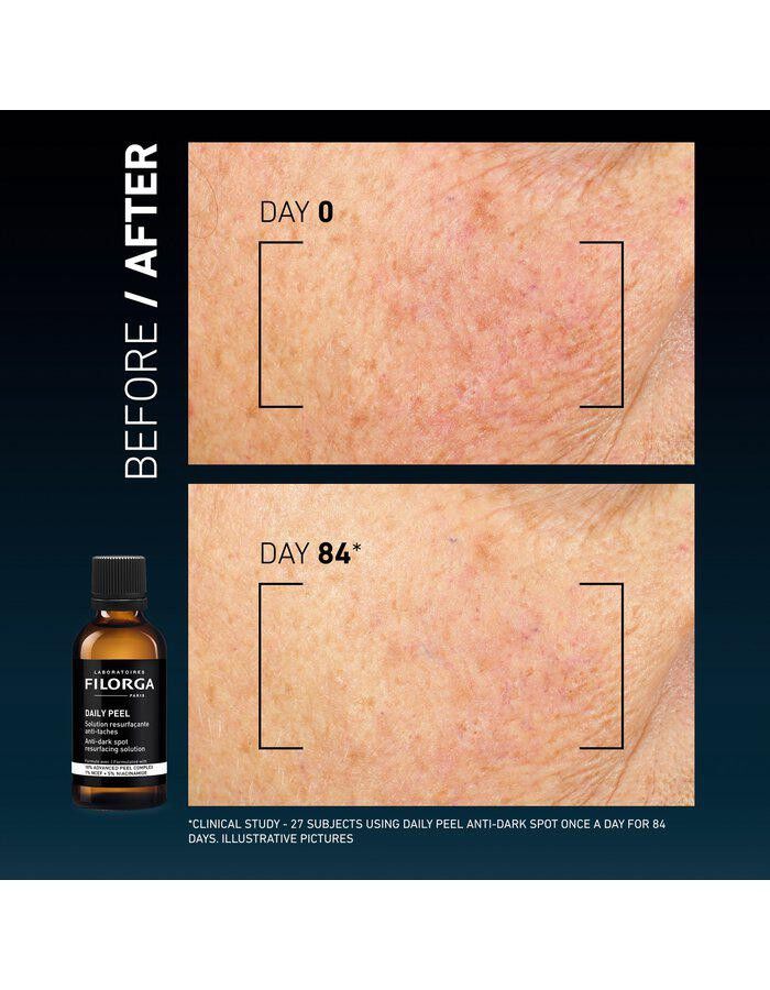 Clinical Home Peel Dark Spot 50 ml