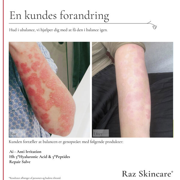 Raz Skincare Repair Salve 100 ml