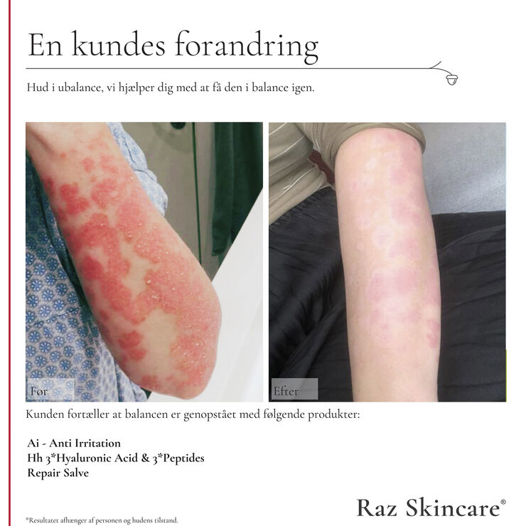 Raz Skincare Repair Salve 100 ml