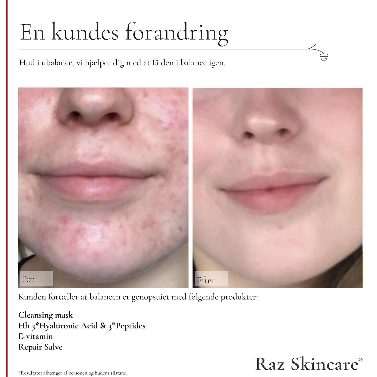 Raz Skincare Cleansing Mask 200 g