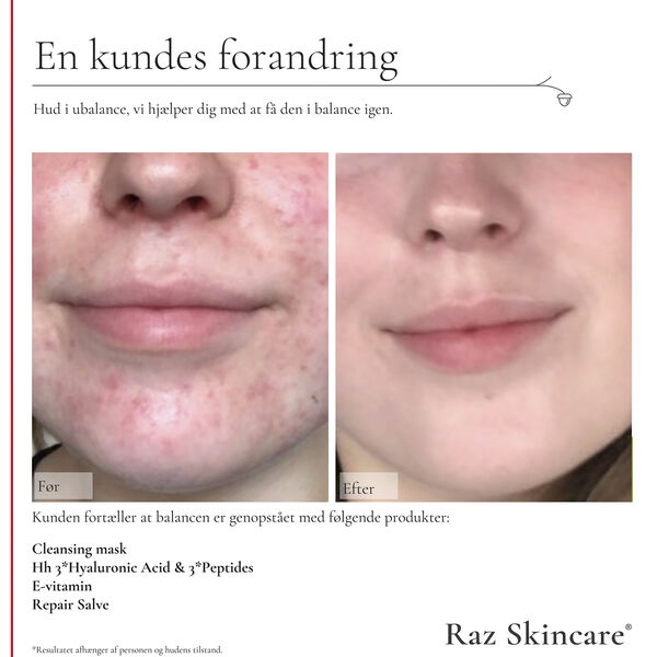 Raz Skincare Cleansing Mask 200 g