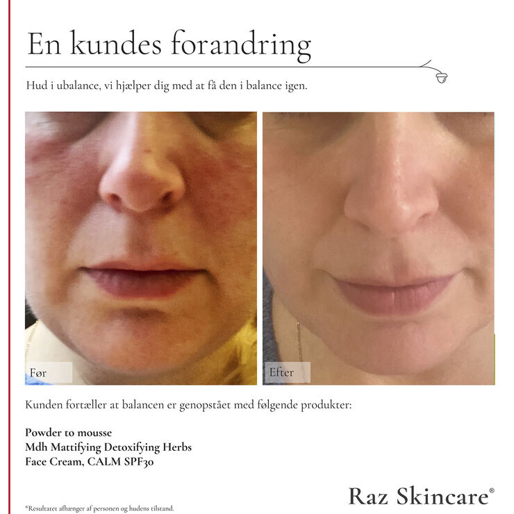 Raz Skincare Mdh Mattifying Detoxifying Herbs 30 ml