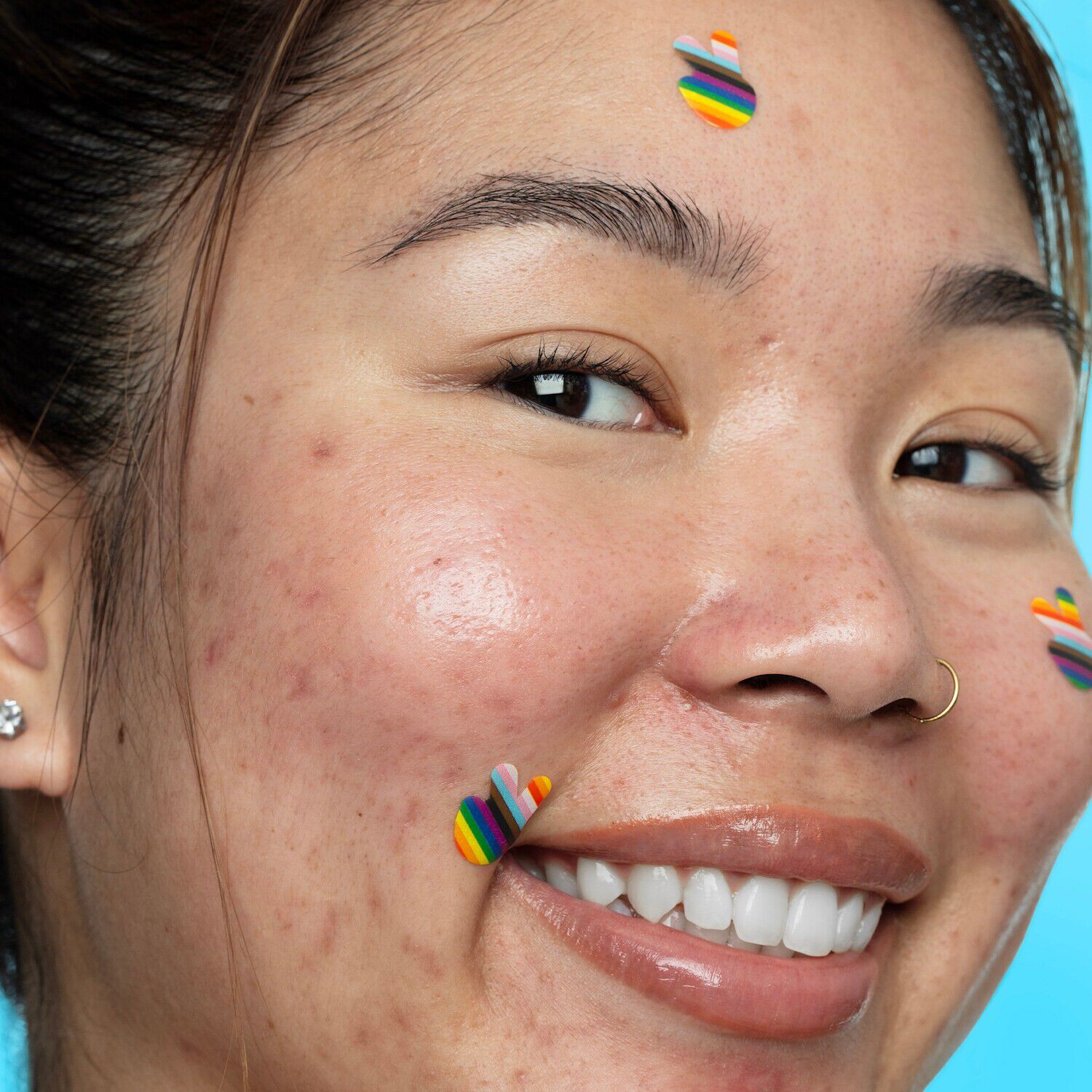 Pride Limited Edition-Timbres f&ouml;r behandling av akne med salicylsyra