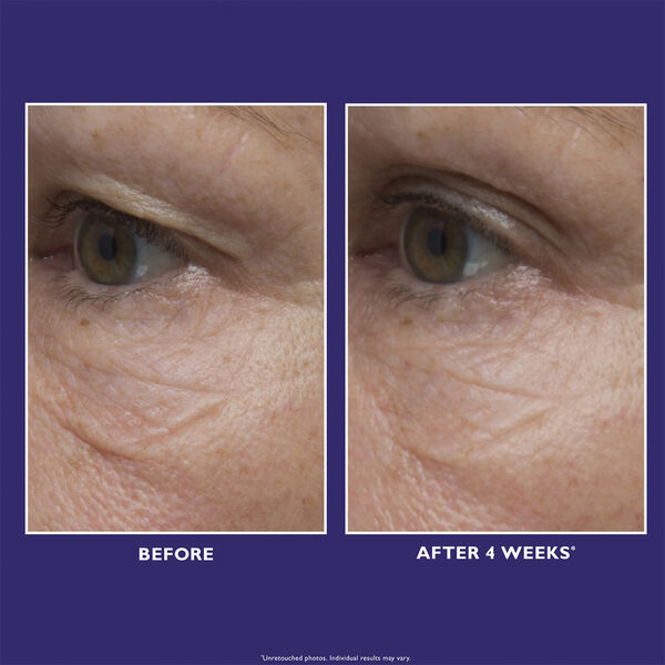 Peter Thomas Roth Ultimate Solution 5 Multitasking Eye Cream