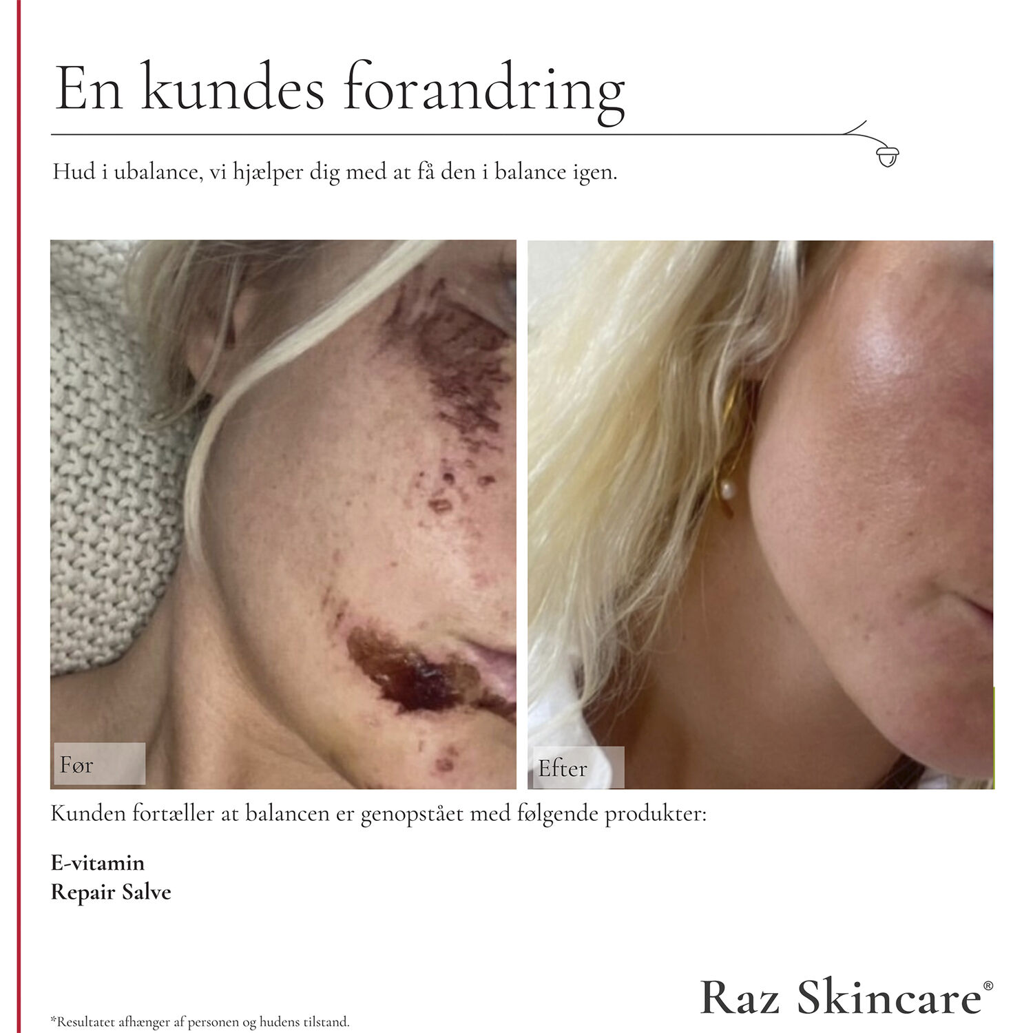 Raz Skincare E-Vitamin 30 ml