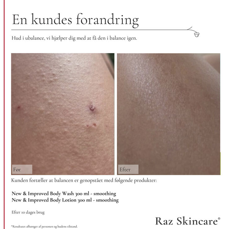 Smoothing Body Lotion