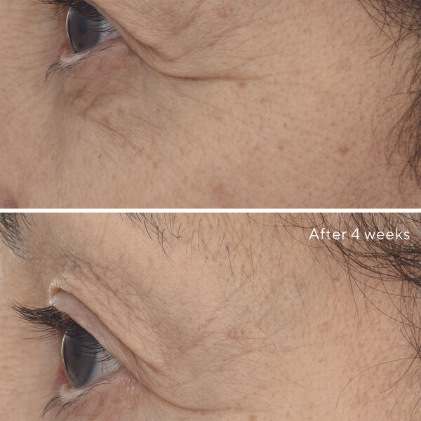 RETINAL RESCUPLT EYE TREATMENT 15 ML