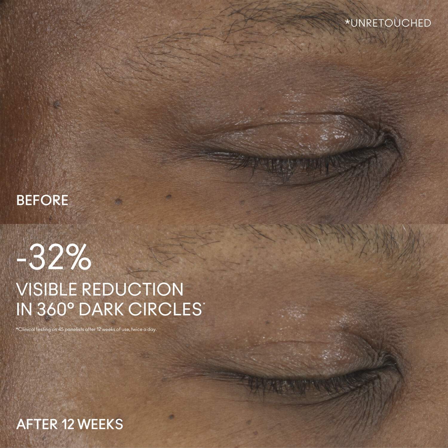 Hyper Real Serumizer 360 Bright Eye Treatment