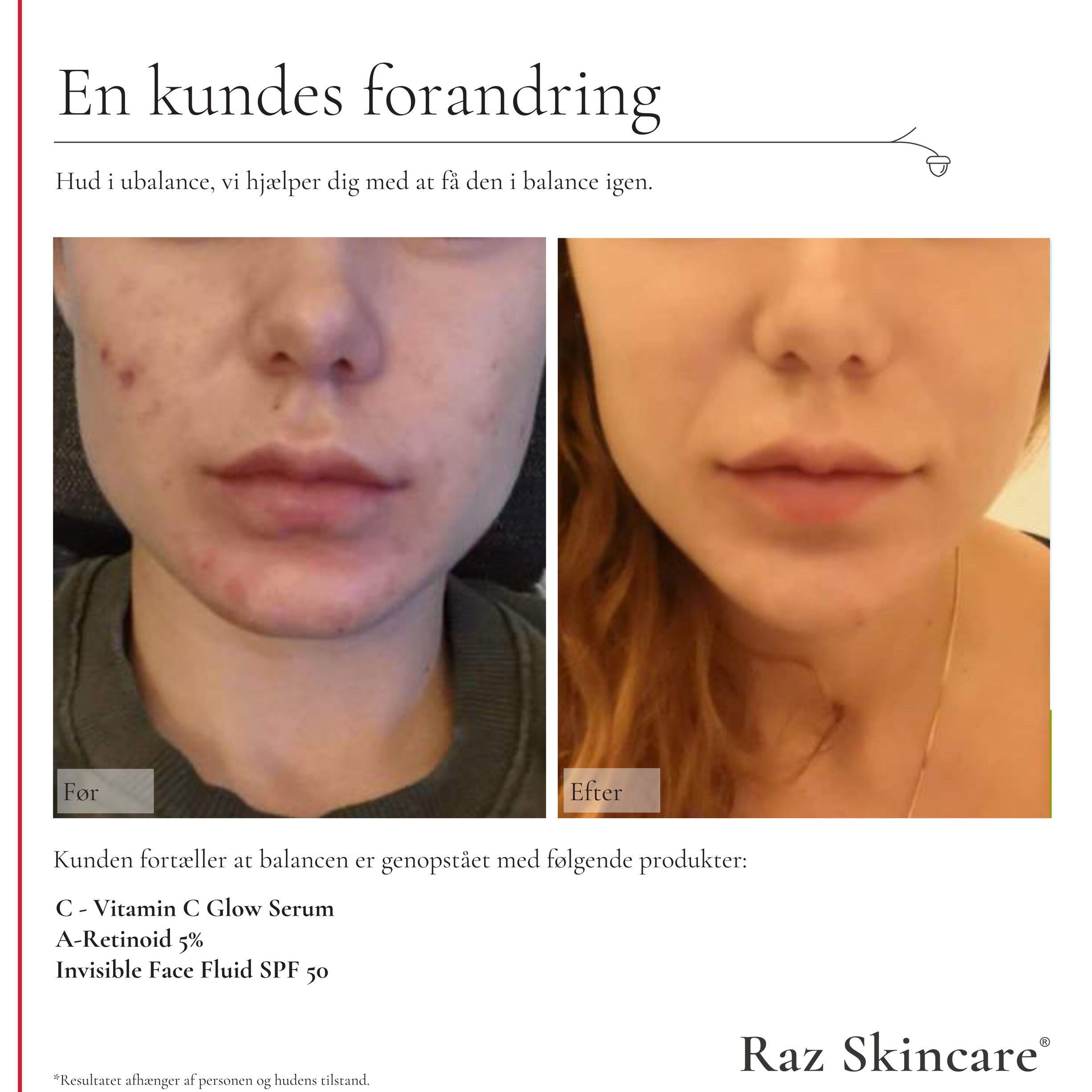 Raz Skincare C - Vitamin C Glow Serum 30 ml