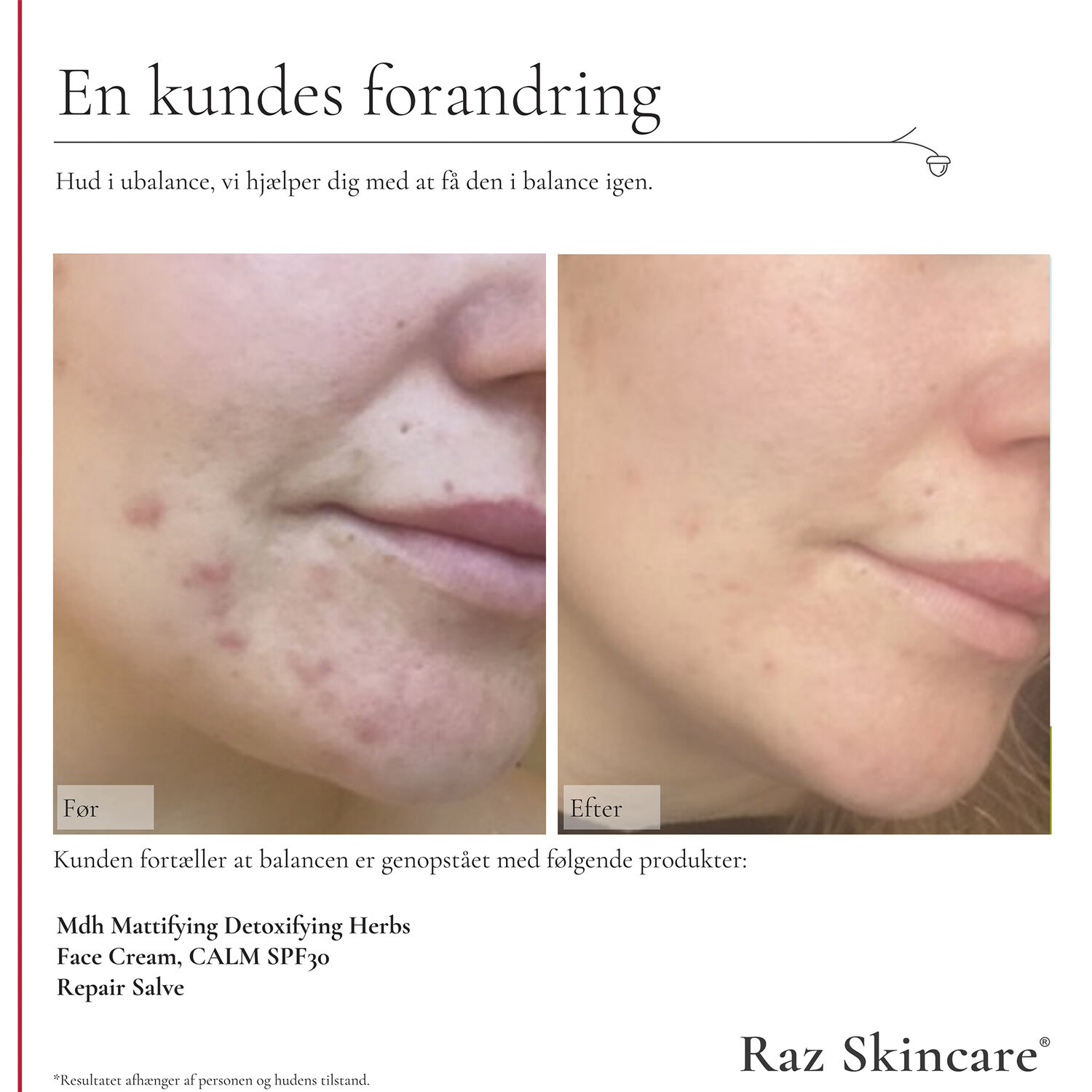 Reparationssalva, Parfymfri 15 ml