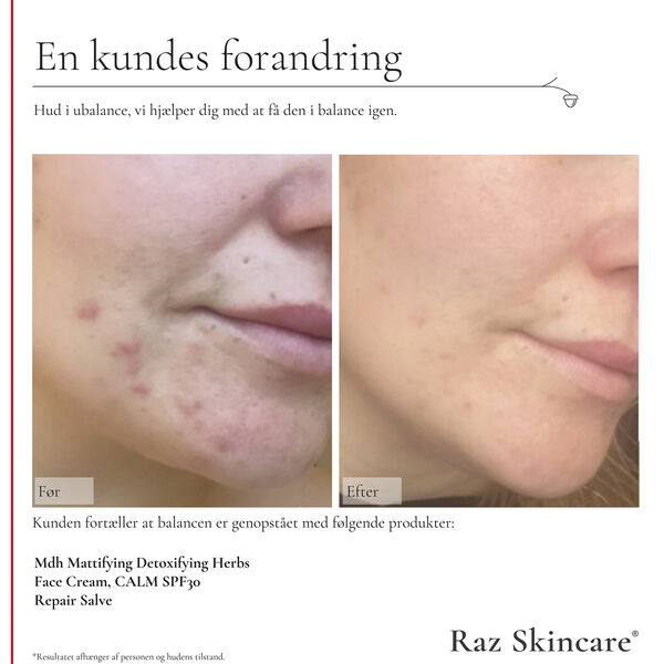 Reparationssalva, Parfymfri 15 ml